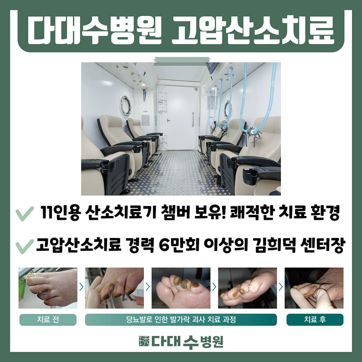 첨부파일